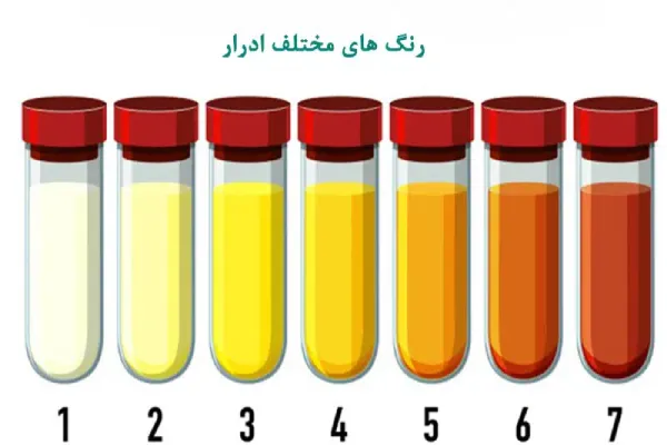 رنگهای مختلف ادرار