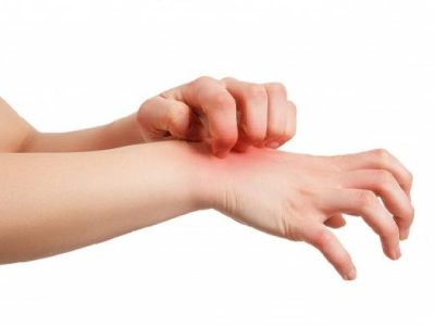 علت-لذت-خارش