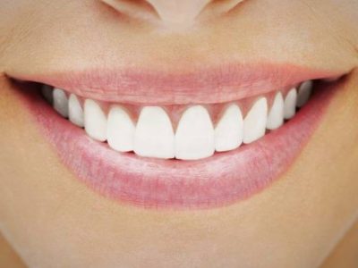 لثه-و-دندان-سالم