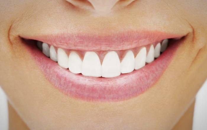 تغذیه مناسب و داشتن لثه و دندان های سالم لثه-و-دندان-سالم