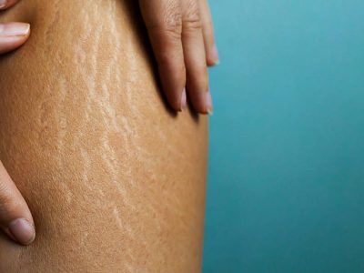 ترک بارداری