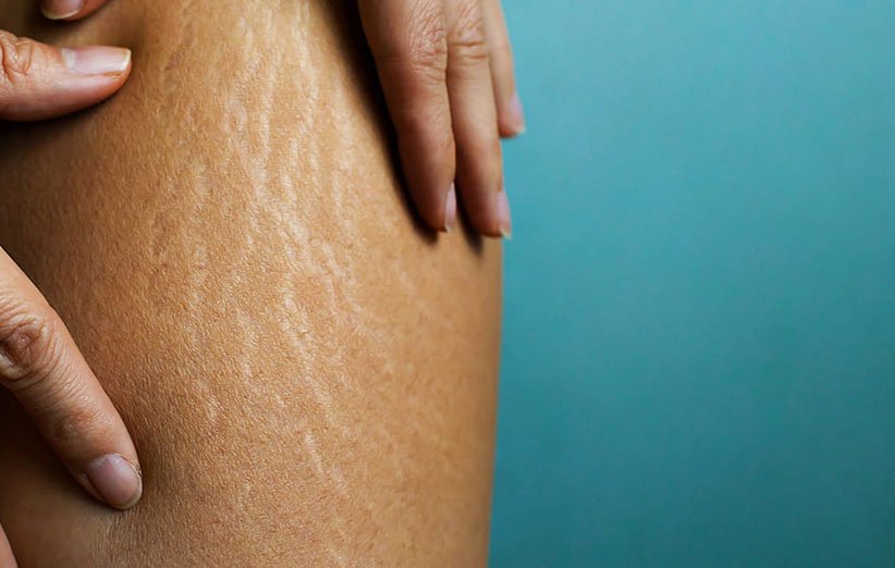 راهکارهای ساده برای جلوگیری از ترک بارداری ترک بارداری