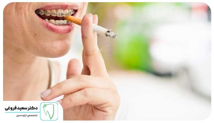 آیا سیگار برای ارتودنسی ضرر دارد