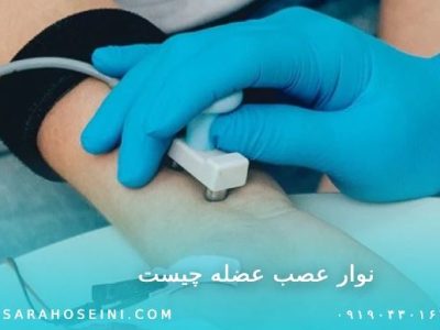 نوار عصب عضله